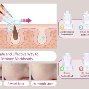 NEW Blackhead Remover Pore Vacuum Cleaner